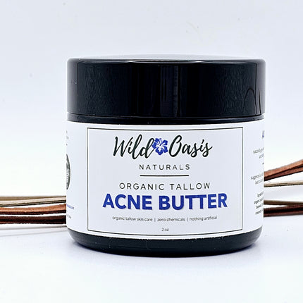 Acne Butter - Organic Tallow Acne Cream