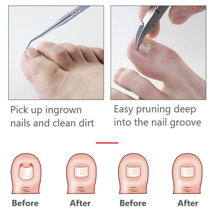 Dead Skin Dirt Remover Pedicure Care Tool