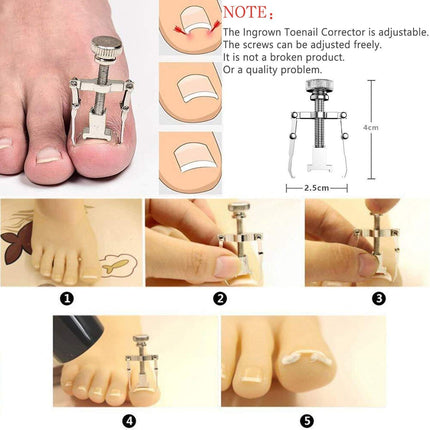 11Pcs/Set Ingrown Toenail Tools Kit Nail Care Pedicure Tools
