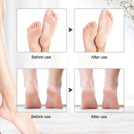 Rechargeable Foot Grinder USB Rechargeable Feet Callus Remover Foot