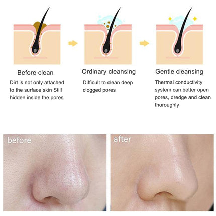 Electric cleanser Facial Cleansing Brush Face Skin Care Tools