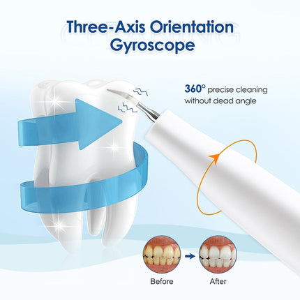 Ultrasonic Visual Dental Cleaning Teeth Whitening Kit Tartar