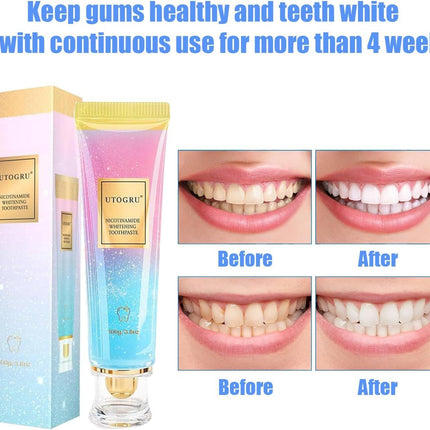 Niacinamide Whitening Toothpaste, Utogru Teeth Radiant Whitening