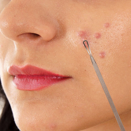 7 Pcs Blackhead Remover Kit Stainless Steel Pimple Comedone Acne