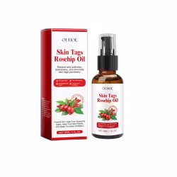 Skin Tags Rosehip Oil Skin Tags Rosehip Oil